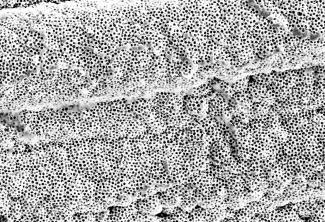 Harsh Wadhwani - Macroporous Silver